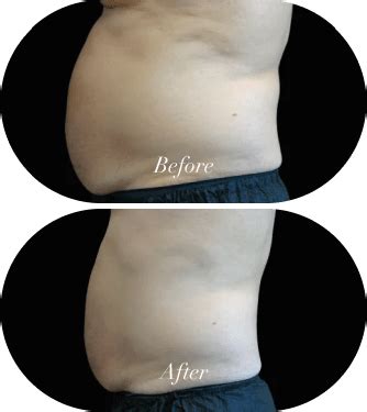 24 Emsculpt doctors & clinics in San Diego, CA .